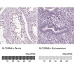 Merck Anti-SLC26A8 antibody produced in rabbit