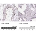 Merck Anti-TEX15 antibody produced in rabbit