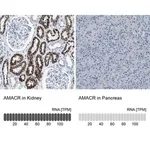 Merck Anti-AMACR antibody produced in rabbit