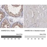 Merck Anti-ANKRD13A antibody produced in rabbit