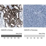 Merck Anti-AMACR antibody produced in rabbit