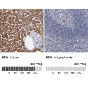 Merck Anti-BDH1 antibody produced in rabbit