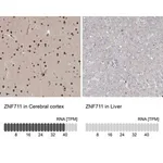 Merck Anti-ZNF711 antibody produced in rabbit