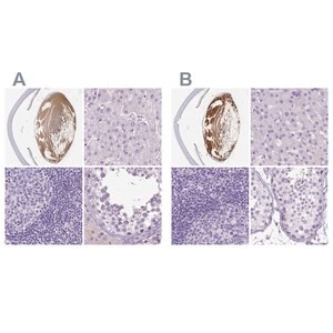 Merck Anti-LGSN antibody produced in rabbit
