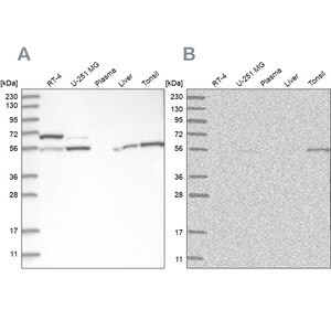 Merck Anti-PPM1F antibody produced in rabbit