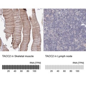 Merck Anti-TACC2 antibody produced in rabbit