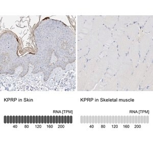 Merck Anti-KPRP antibody produced in rabbit
