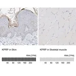 Merck Anti-KPRP antibody produced in rabbit