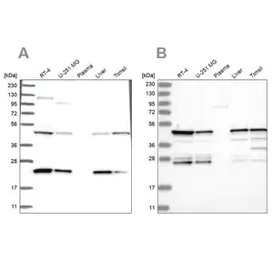 Merck Anti-PPP1R7 antibody produced in rabbit
