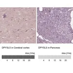 Merck Anti-DPYSL5 antibody produced in rabbit