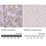 Merck Anti-RNF186 antibody produced in rabbit