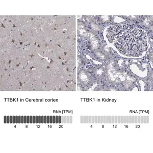 Merck Anti-TTBK1 antibody produced in rabbit