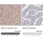 Merck Anti-HECW2 antibody produced in rabbit