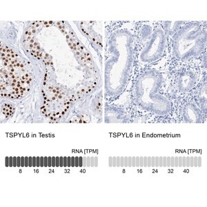 Merck Anti-TSPYL6 antibody produced in rabbit
