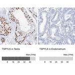 Merck Anti-TSPYL6 antibody produced in rabbit