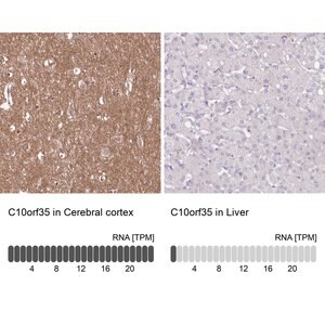 Merck Anti-C10orf35 antibody produced in rabbit