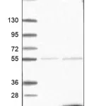 Merck Anti-TBCA antibody produced in rabbit