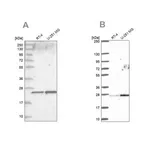 Merck Anti-NOP16 antibody produced in rabbit