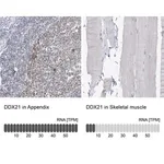 Merck Anti-DDX21 antibody produced in rabbit