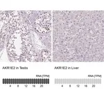 Merck Anti-AKR1E2 antibody produced in rabbit