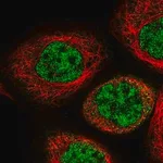 Merck Anti-IPMK antibody produced in rabbit