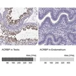 Merck Anti-ACRBP antibody produced in rabbit