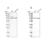 Merck Anti-P2RX7 antibody produced in rabbit