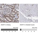 Merck Anti-AKAP11 antibody produced in rabbit