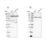Merck Anti-TBC1D5 antibody produced in rabbit