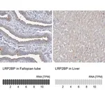 Merck Anti-LRP2BP antibody produced in rabbit
