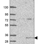 Merck Anti-CIB2 antibody produced in rabbit
