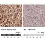Merck Anti-GBE1 antibody produced in rabbit