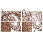 Merck Anti-GBE1 antibody produced in rabbit