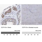Merck Anti-CCP110 antibody produced in rabbit