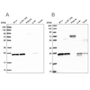 Merck Anti-MESDC2 antibody produced in rabbit