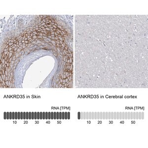Merck Anti-ANKRD35 antibody produced in rabbit