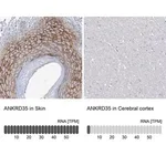 Merck Anti-ANKRD35 antibody produced in rabbit