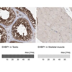 Merck Anti-EHBP1 antibody produced in rabbit