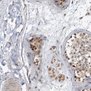 Merck Anti-KIF15 antibody produced in rabbit