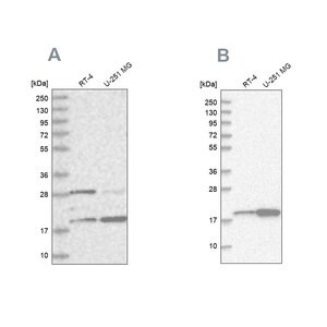 Merck Anti-CGGBP1 antibody produced in rabbit