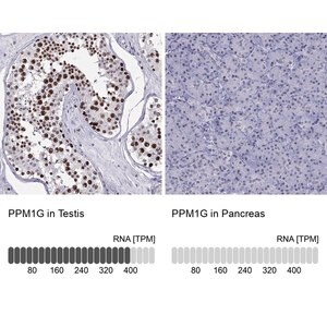 Merck Anti-PPM1G antibody produced in rabbit