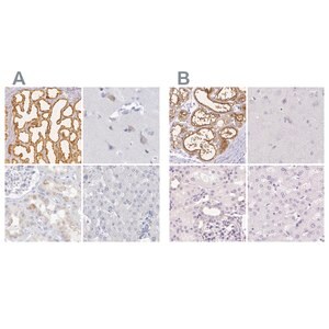 Merck Anti-CSN1S1 antibody produced in rabbit
