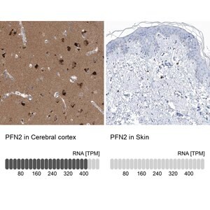 Merck Anti-PFN2 antibody produced in rabbit