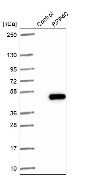 Merck Anti-RPP40 antibody produced in rabbit