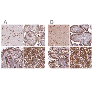 Merck Anti-QARS antibody produced in rabbit