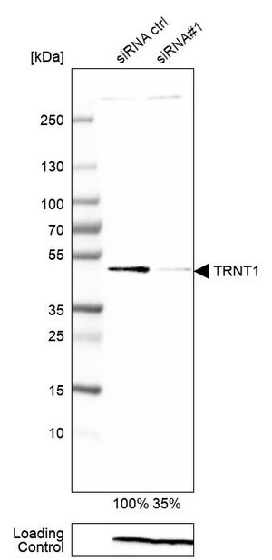 Merck Anti-TRNT1 antibody produced in rabbit