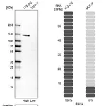 Merck Anti-RAI14 antibody produced in rabbit