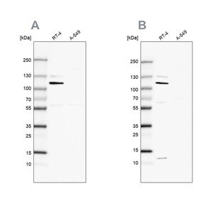 Merck Anti-MCC antibody produced in rabbit