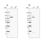 Merck Anti-MCC antibody produced in rabbit