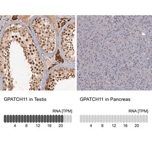 Merck Anti-GPATCH11 antibody produced in rabbit